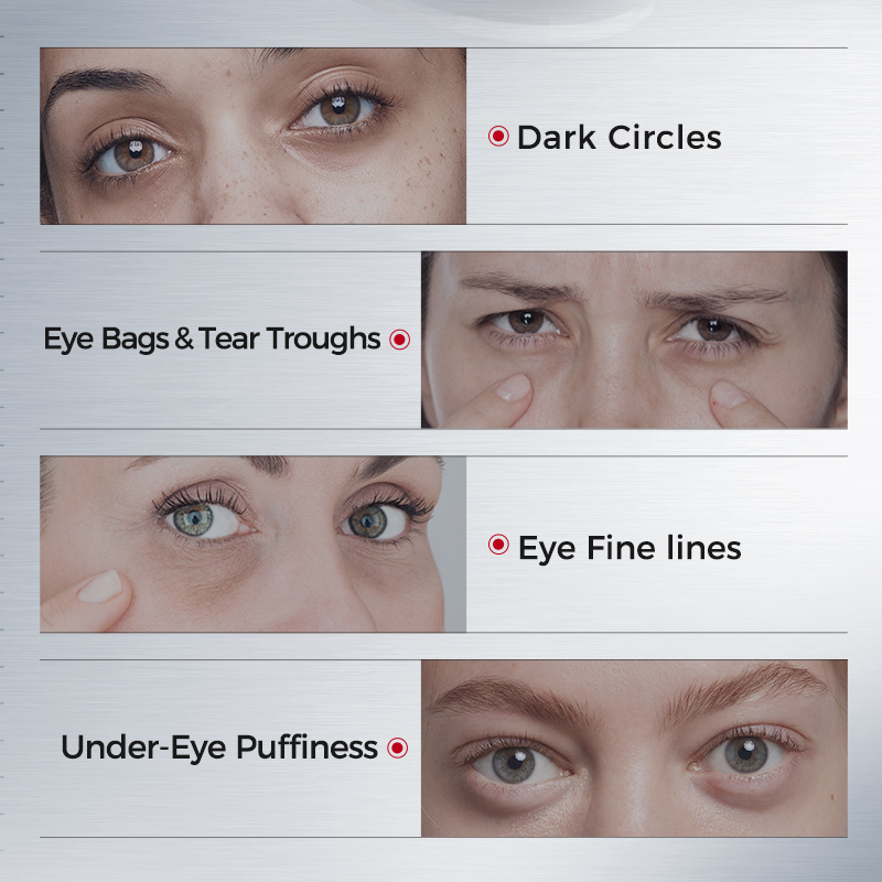 Eye Patches for Dark Circles – - Collagen Under Eye Patches ulasan dan harga