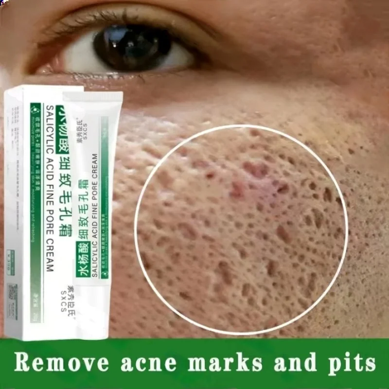 Salicylic Acid Pore Clearing C - Salicylic Acid Blackhead Remover ulasan dan harga