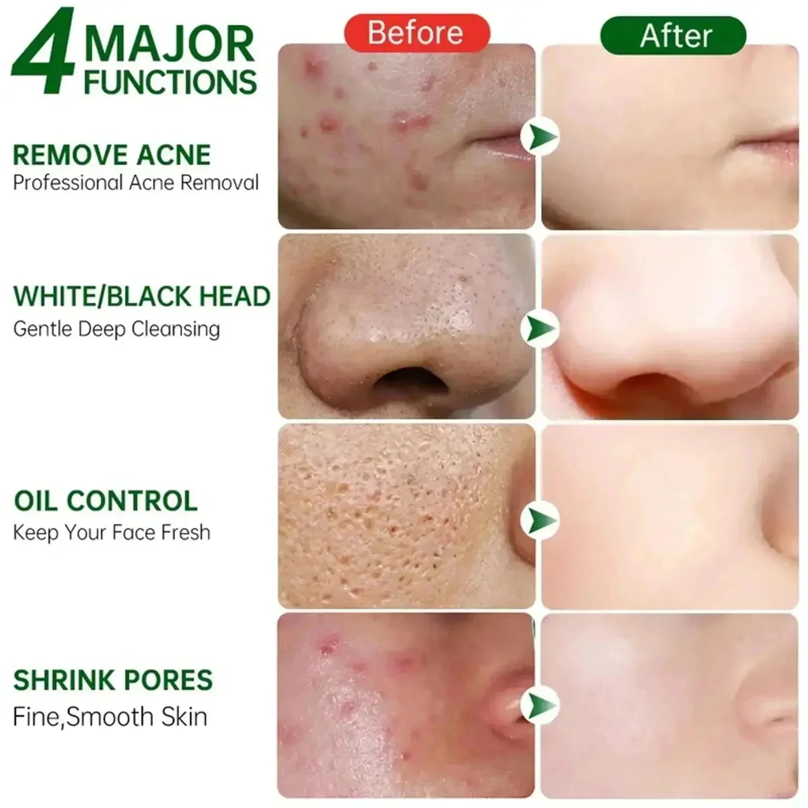Salicylic Acid Pore Clearing C - Salicylic Acid Blackhead Remover ulasan dan harga