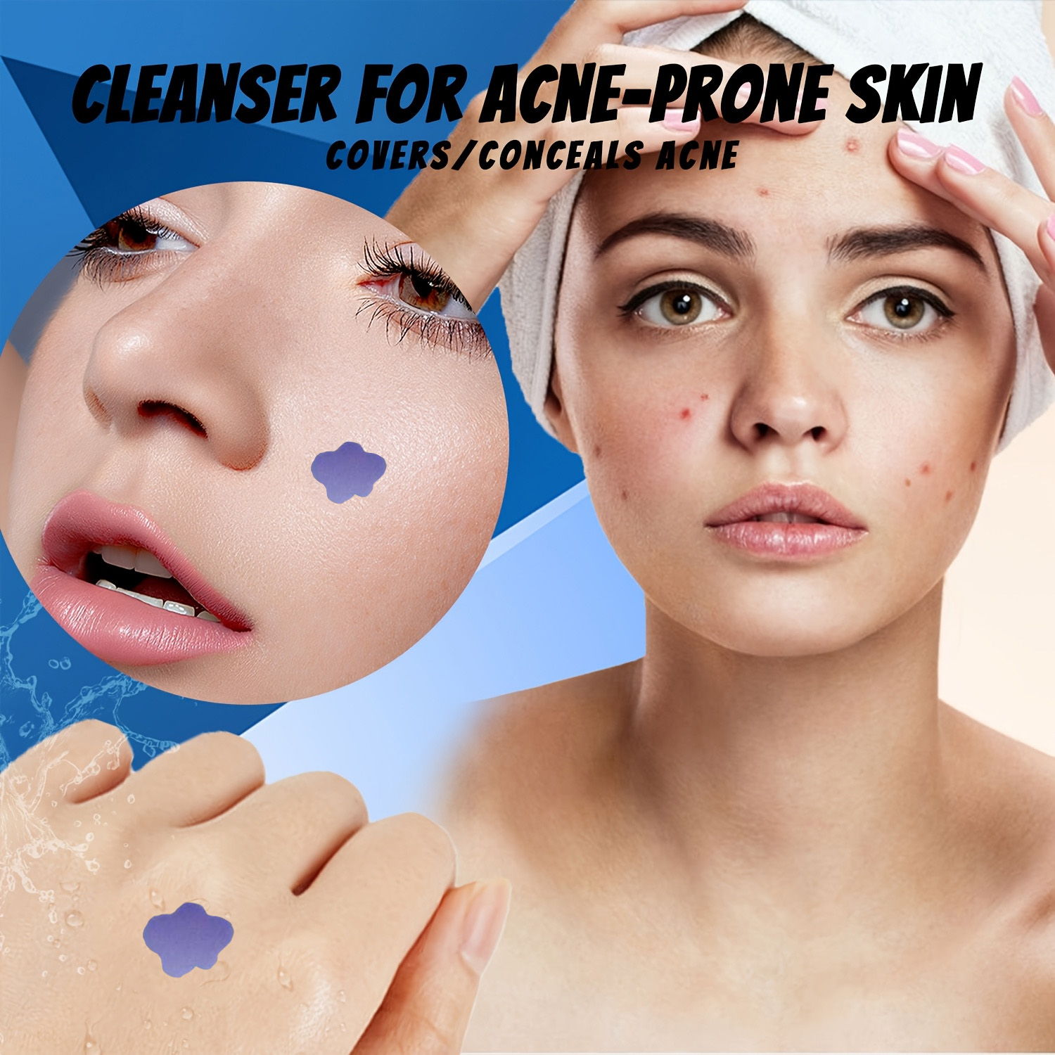 Microneedle Acne Pimple Patch  - Skincare ulasan dan harga