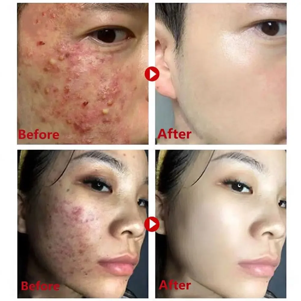 Green Tea Mask Stick Remove Bl - Green Tea Cleansing Clay Mask ulasan dan harga