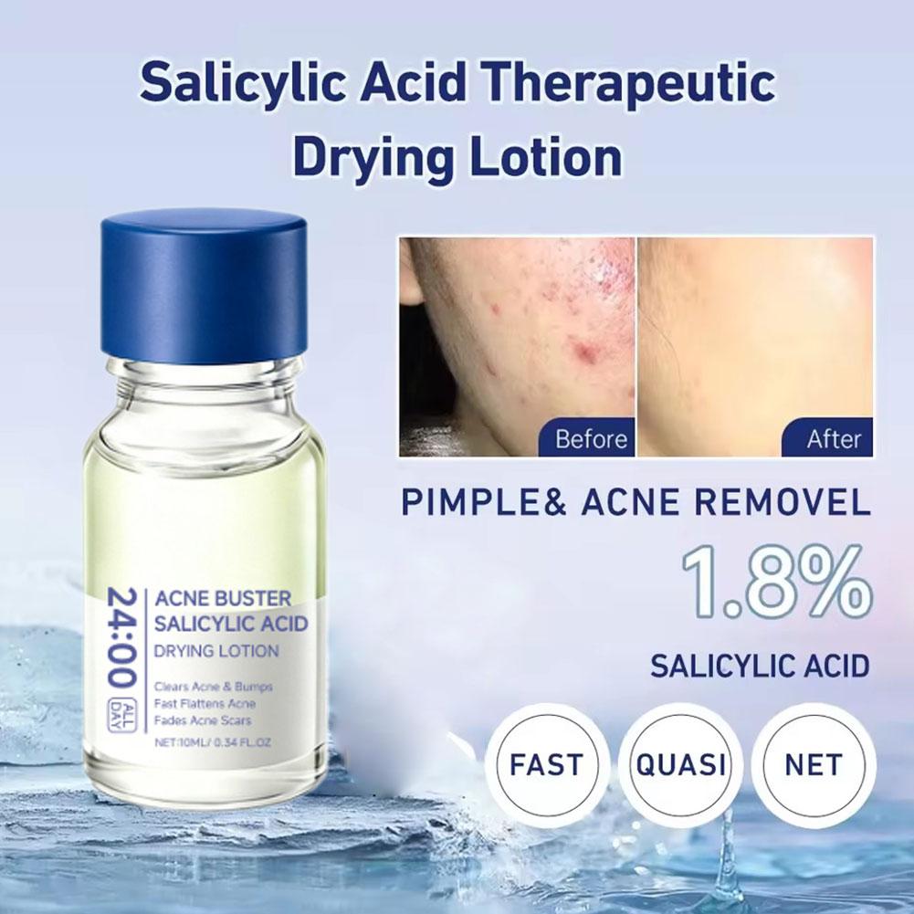 Salicylic Acid Acne Buster Rem - Salicylic Acid Blackhead Remover ulasan dan harga